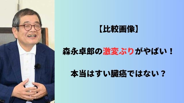 【比較画像】森永卓郎の激変ぶりがやばい！本当はすい臓癌ではない？